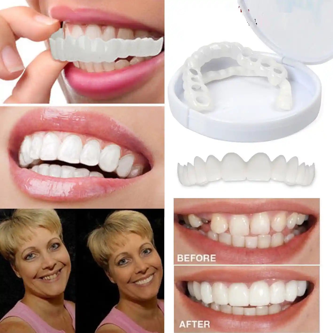 Sonriplus™ 😁💎 – Devuelve a tu sonrisa un aspecto natural y radiante al instante 🌟🦷